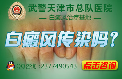 导致儿童白癜风患病的因素有哪些呢